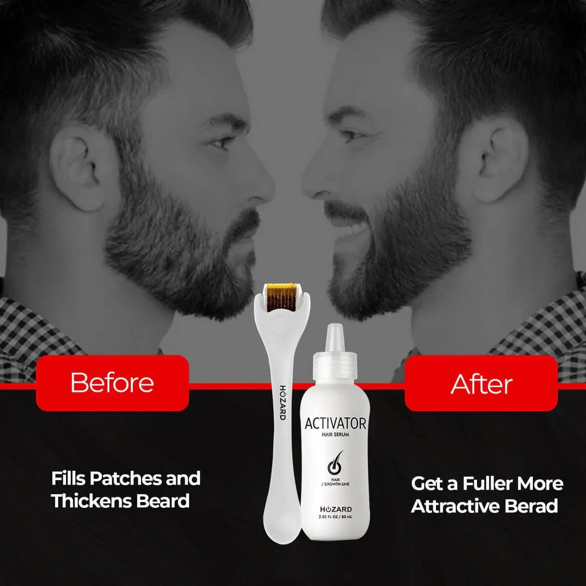 Voor en na baardgroei met activator serum en dermaroller, vollere baard, haarverzorging.