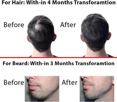 Voor en na transformatie van haar en baardgroei bij man, zichtbaar verschil na maanden.